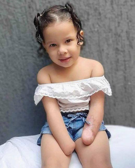 She lost her hands—but never her spirit.