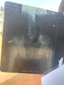 Elderly man alone in despair, looking weak and in need of medical help 💔🧓🏾