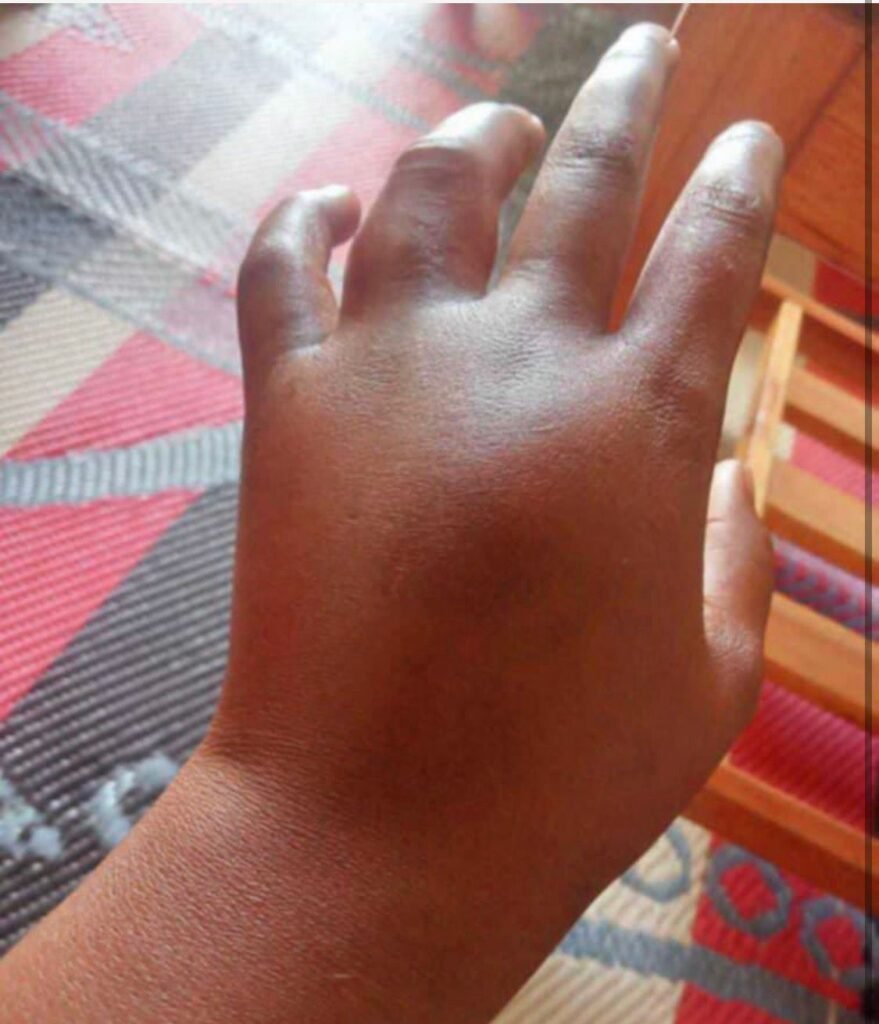 A man pleading for help to save his wife, who has cancer and needs her leg amputated. He asks for prayers and financial support to raise 450,000 KSh for surgery at Top Hill Hospital in Eldoret, Kenya. The message is filled with crying and prayer emojis, expressing deep emotional pain.