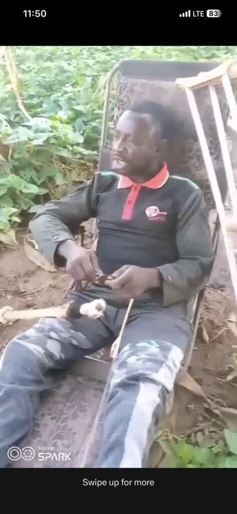 DSP Musa Adamu, a Nigerian police officer, lying in a hospital bed after being shot on duty, fighting for his life without support from the police.